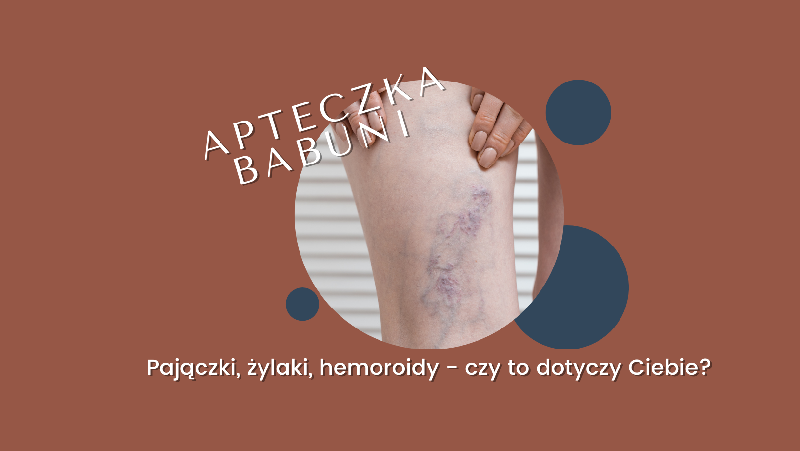 Read more about the article Pajączki, żylaki, hemoroidy – czy to Ciebie dotyczy?